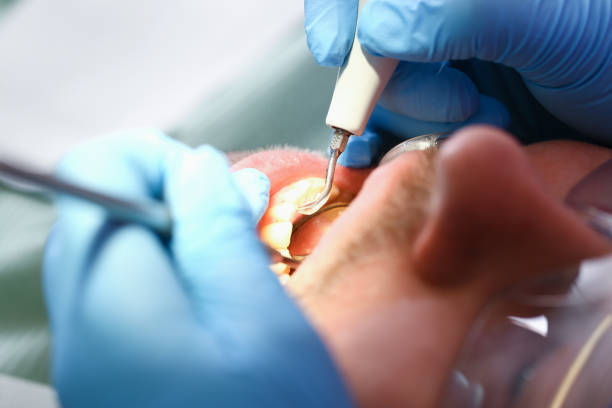 Best Emergency Cosmetic Dentistry (e.g., broken veneers) in Minden, LA
